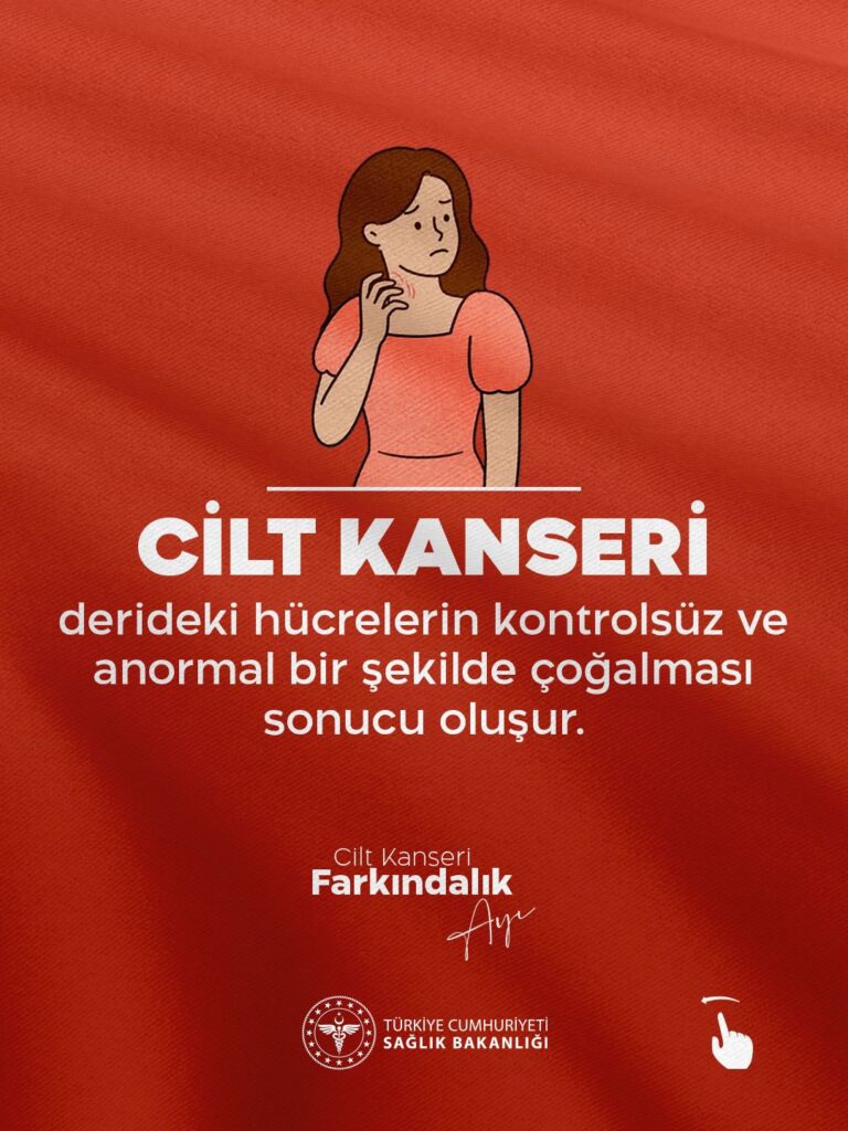 Cilt kanseri hakkında önemli bilgiler paylaşıldı