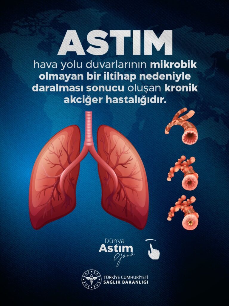 Astım kontrolü için 6 altın kural önerisi